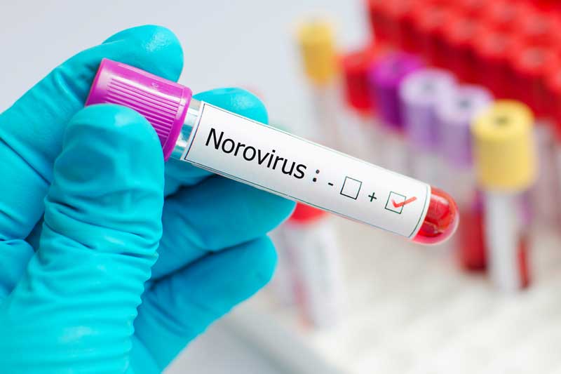 Norovirus Infection Symptoms